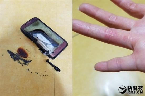 三星Galaxy S7突然爆炸自燃：20岁姑娘被烧伤（图）  新闻资讯  第2张