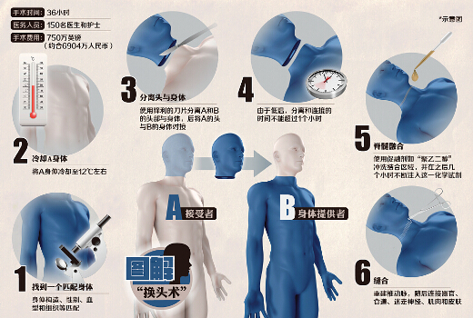 哈医大任晓平回应头移植手术：我是医生，不是伦理学家 罗宣 观察者网 人体 动物 人类 发布会 外科 换头 换头术 手术 新闻资讯  第1张